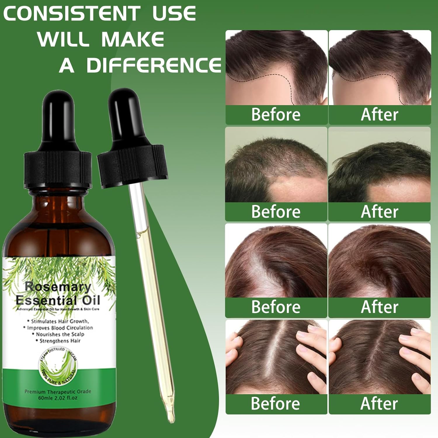 3 Pack Rosemary Essential Oil for Hair Growth - OLELON